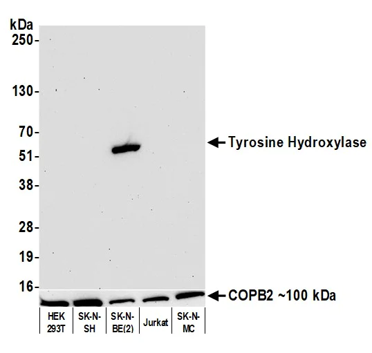 Western blot - Anti-Tyrosine Hydroxylase antibody [BLR155J] - BSAfree (AB314080)