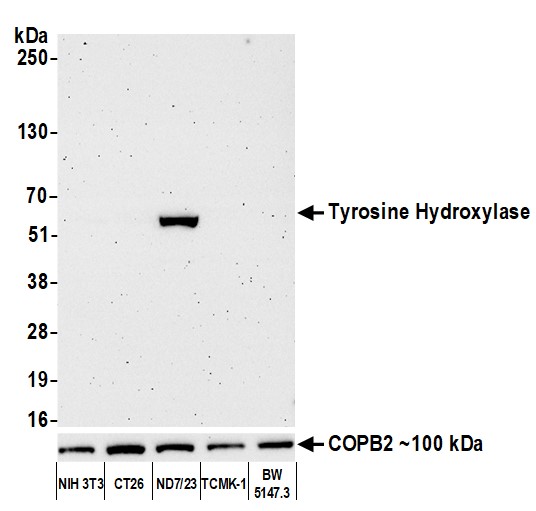 Western blot - Anti-Tyrosine Hydroxylase antibody [BLR155J] - BSAfree (AB314080), expandable thumbnail