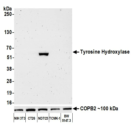 Western blot - Anti-Tyrosine Hydroxylase antibody [BLR155J] - BSAfree (AB314080)