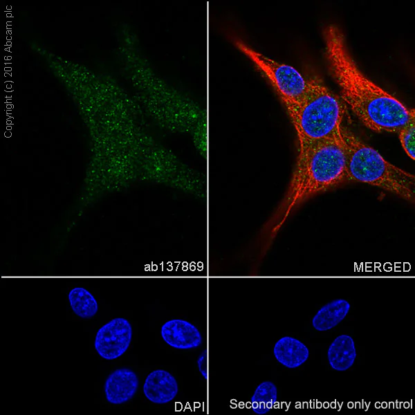 Immunocytochemistry/ Immunofluorescence - Anti-Tyrosine Hydroxylase antibody [EP1532Y] - BSA and Azide free (AB220218)