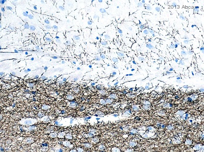 Immunohistochemistry (Formalin/PFA-fixed paraffin-embedded sections) - Anti-Tyrosine Hydroxylase antibody [EP1532Y] - BSA and Azide free (AB220218), expandable thumbnail