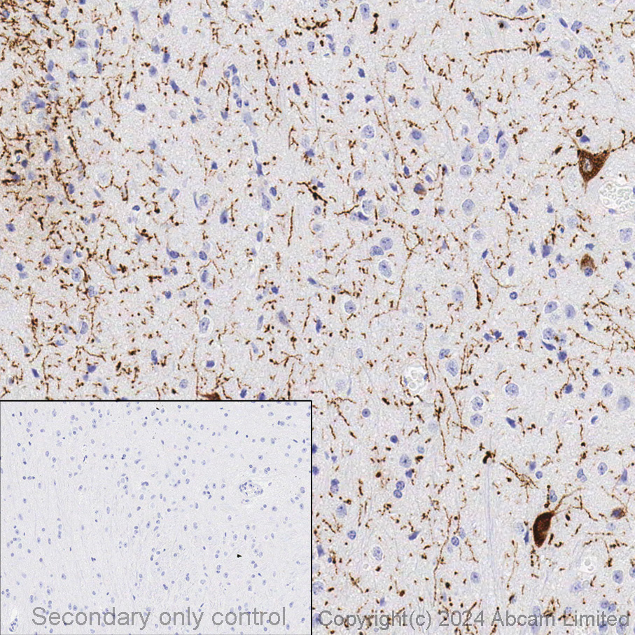 Immunohistochemistry (Formalin/PFA-fixed paraffin-embedded sections) - Anti-Tyrosine Hydroxylase antibody [EP1532Y] - BSA and Azide free (ab220218), expandable thumbnail