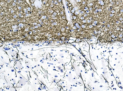 Immunohistochemistry (Formalin/PFA-fixed paraffin-embedded sections) - Anti-Tyrosine Hydroxylase antibody [EP1532Y] - BSA and Azide free (AB220218), expandable thumbnail