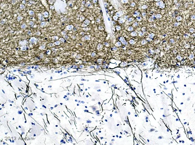 Immunohistochemistry (Formalin/PFA-fixed paraffin-embedded sections) - Anti-Tyrosine Hydroxylase antibody [EP1532Y] - BSA and Azide free (AB220218)