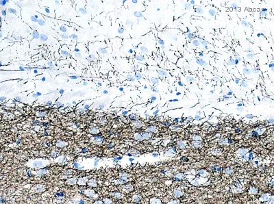 Immunohistochemistry (Formalin/PFA-fixed paraffin-embedded sections) - Anti-Tyrosine Hydroxylase antibody [EP1532Y] - Neuronal Marker (AB137869)