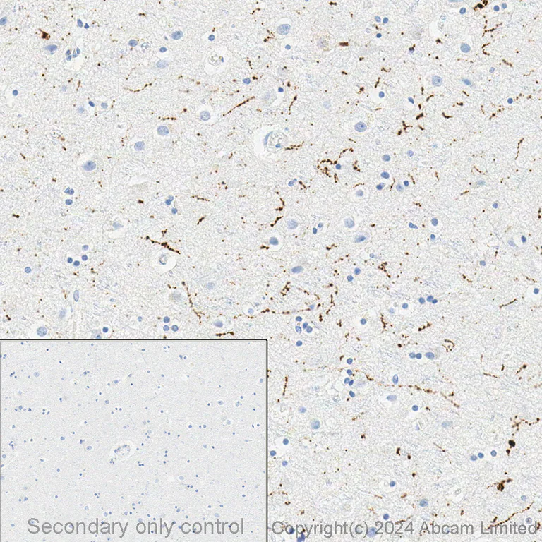 Immunohistochemistry (Formalin/PFA-fixed paraffin-embedded sections) - Anti-Tyrosine Hydroxylase antibody [EP1532Y] - Neuronal Marker (AB137869)