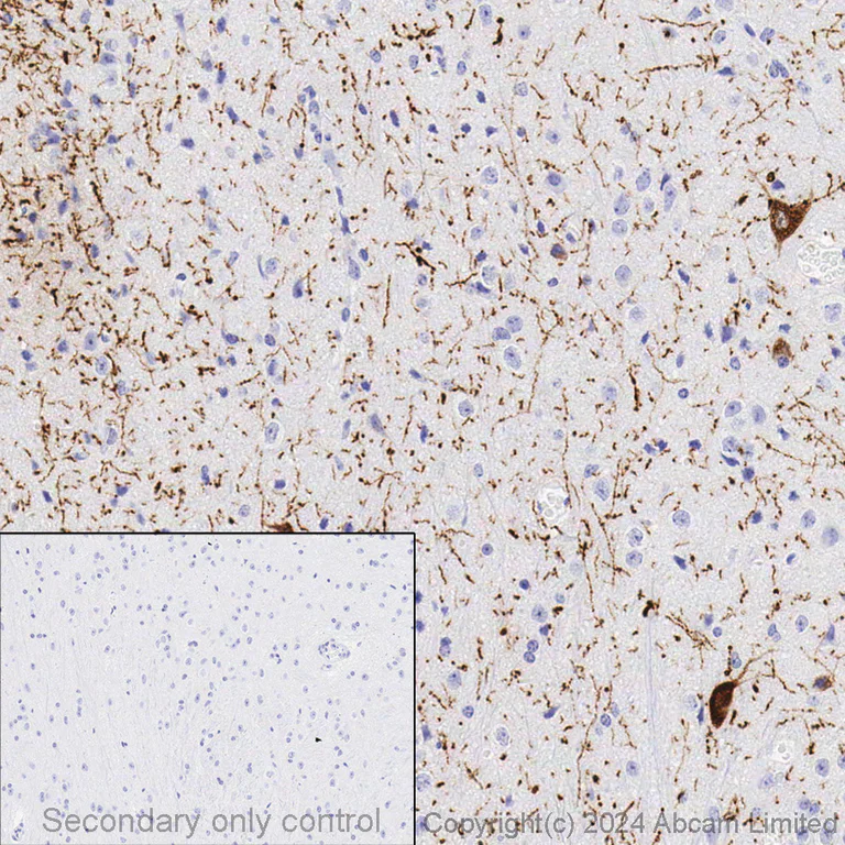 アレルギー Alexa Fluor® 647 Anti-Cytokeratin 8 抗体 [EP1628Y] (ab192468)