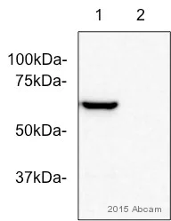 Anti-Tyrosine Hydroxylase antibody [EP1532Y] 20 ul size
