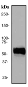 Western blot - Anti-Tyrosine Hydroxylase antibody [EP1532Y] - Neuronal Marker (AB137869)