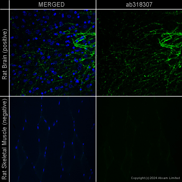 Immunohistochemistry (Formalin/PFA-fixed paraffin-embedded sections) - Anti-Tyrosine Hydroxylase antibody [EP1532Y] - Neuronal Marker – Chicken IgY (Chimeric) (AB318304), expandable thumbnail