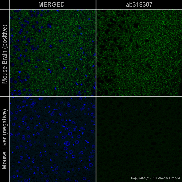 Immunohistochemistry (Formalin/PFA-fixed paraffin-embedded sections) - Anti-Tyrosine Hydroxylase antibody [EP1532Y] - Neuronal Marker – Chicken IgY (Chimeric) (AB318304), expandable thumbnail