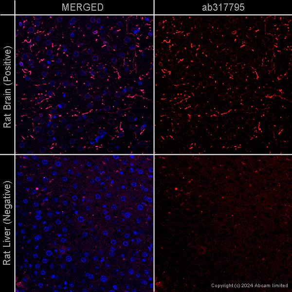Immunohistochemistry (Formalin/PFA-fixed paraffin-embedded sections) - Anti-Tyrosine Hydroxylase antibody [EP1532Y] - Neuronal Marker – Goat IgG (Chimeric) (AB317785)