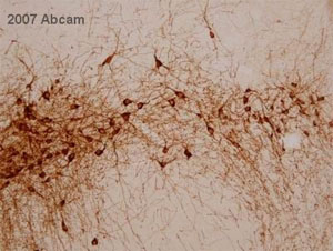 Immunohistochemistry (Formalin/PFA-fixed paraffin-embedded sections) - Anti-Tyrosine Hydroxylase antibody - Neuronal Marker (AB112), expandable thumbnail