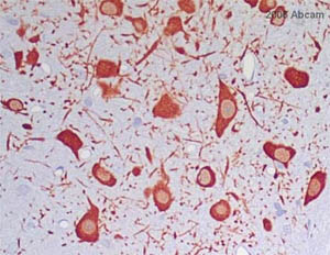 Immunohistochemistry (Formalin/PFA-fixed paraffin-embedded sections) - Anti-Tyrosine Hydroxylase antibody - Neuronal Marker (AB112), expandable thumbnail