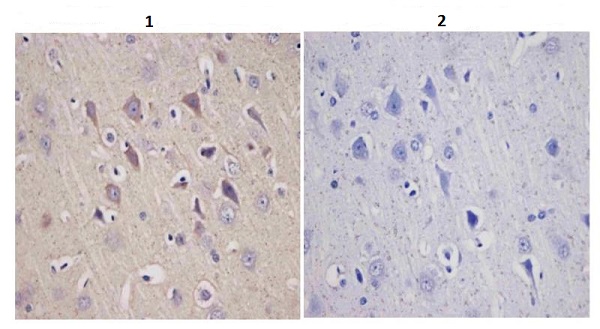 Immunohistochemistry (Formalin/PFA-fixed paraffin-embedded sections) - Anti-Tyrosine Hydroxylase antibody - Neuronal Marker (AB112), expandable thumbnail
