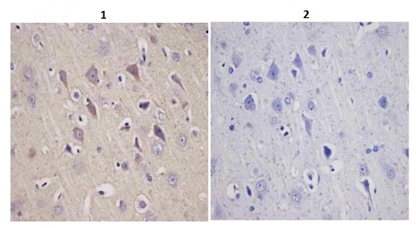 Immunohistochemistry (Formalin/PFA-fixed paraffin-embedded sections) - Anti-Tyrosine Hydroxylase antibody - Neuronal Marker (AB112)