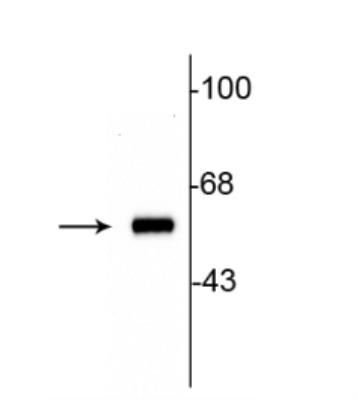 Western blot - Anti-Tyrosine Hydroxylase antibody - Neuronal Marker (ab112), expandable thumbnail