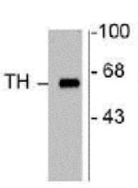 Western blot - Anti-Tyrosine Hydroxylase antibody - Neuronal Marker (AB112)