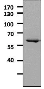 Western blot - Anti-Tyrosine Hydroxylase antibody - Neuronal Marker (AB112)