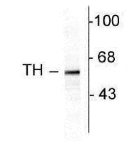 Western blot - Anti-Tyrosine Hydroxylase antibody - Neuronal Marker (AB113)
