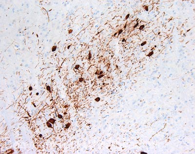 Immunohistochemistry (Formalin/PFA-fixed paraffin-embedded sections) - Anti-Tyrosine Hydroxylase antibody - Neuronal Marker (AB117112)