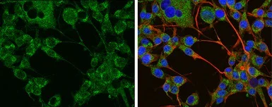 Immunocytochemistry/ Immunofluorescence - Anti-Tyrosine Hydroxylase antibody - Neuronal Marker (AB137721)