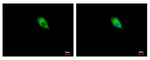 Immunocytochemistry/ Immunofluorescence - Anti-Tyrosine Hydroxylase antibody (AB137721), expandable thumbnail