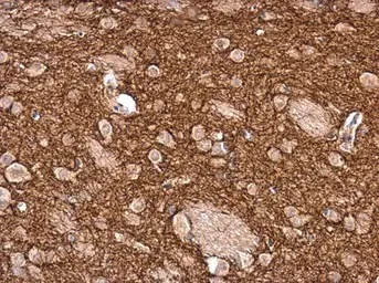 Immunohistochemistry (Formalin/PFA-fixed paraffin-embedded sections) - Anti-Tyrosine Hydroxylase antibody - Neuronal Marker (AB137721)