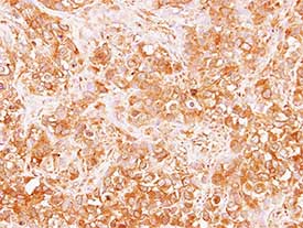 Immunohistochemistry (Formalin/PFA-fixed paraffin-embedded sections) - Anti-Tyrosine Hydroxylase antibody - Neuronal Marker (AB137721), expandable thumbnail