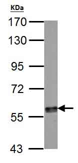 Western blot - Anti-Tyrosine Hydroxylase antibody - Neuronal Marker (AB137721), expandable thumbnail