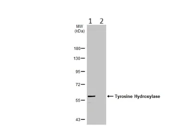 Western blot - Anti-Tyrosine Hydroxylase antibody - Neuronal Marker (AB137721)