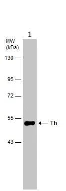 Western blot - Anti-Tyrosine Hydroxylase antibody - Neuronal Marker (AB137721)