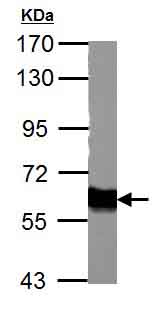 Western blot - Anti-Tyrosine Hydroxylase antibody - Neuronal Marker (AB137721), expandable thumbnail