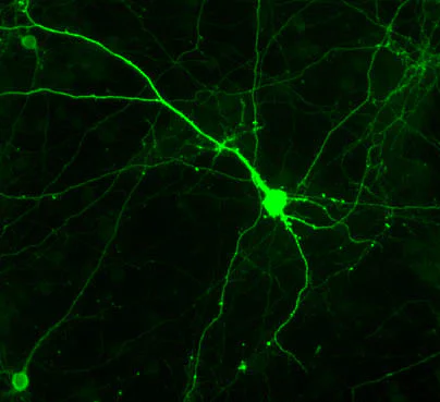 Immunohistochemistry (Frozen sections) - Anti-Tyrosine Hydroxylase antibody - Neuronal Marker (AB6211)