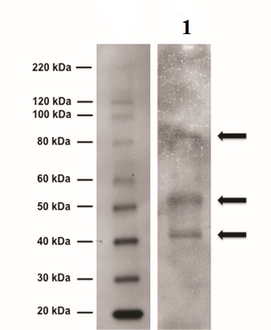 Western blot - Anti-Tyrosine Hydroxylase antibody - Neuronal Marker (AB6211), expandable thumbnail