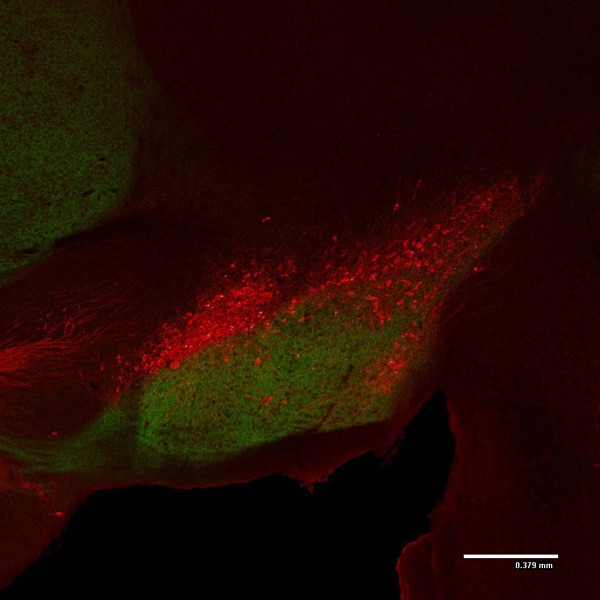 Immunohistochemistry (Formalin/PFA-fixed paraffin-embedded sections) - Anti-Tyrosine Hydroxylase antibody (AB76442), expandable thumbnail