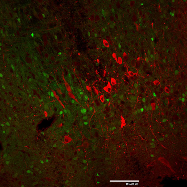 Immunohistochemistry (Formalin/PFA-fixed paraffin-embedded sections) - Anti-Tyrosine Hydroxylase antibody (AB76442), expandable thumbnail