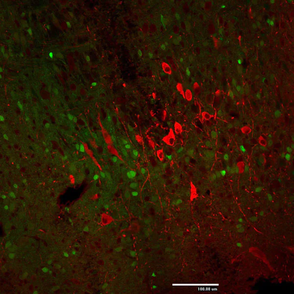 Immunohistochemistry (Formalin/PFA-fixed paraffin-embedded sections) - Anti-Tyrosine Hydroxylase antibody - Neuronal Marker (AB76442)