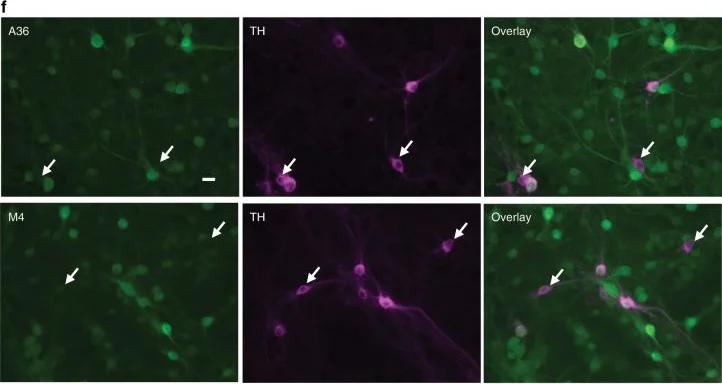 Immunohistochemistry - Anti-Tyrosine Hydroxylase antibody - Neuronal Marker (AB76442)