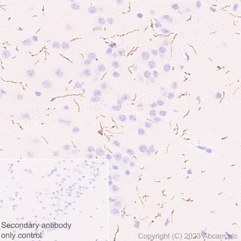 Immunohistochemistry (Formalin/PFA-fixed paraffin-embedded sections) - Anti-Tyrosine Hydroxylase antibody [RM1085] - BSA and Azide free (AB315253)