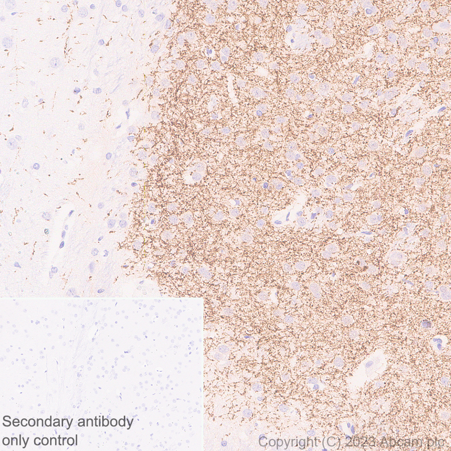 Immunohistochemistry (Formalin/PFA-fixed paraffin-embedded sections) - Anti-Tyrosine Hydroxylase antibody [RM1085] - BSA and Azide free (ab315253), expandable thumbnail