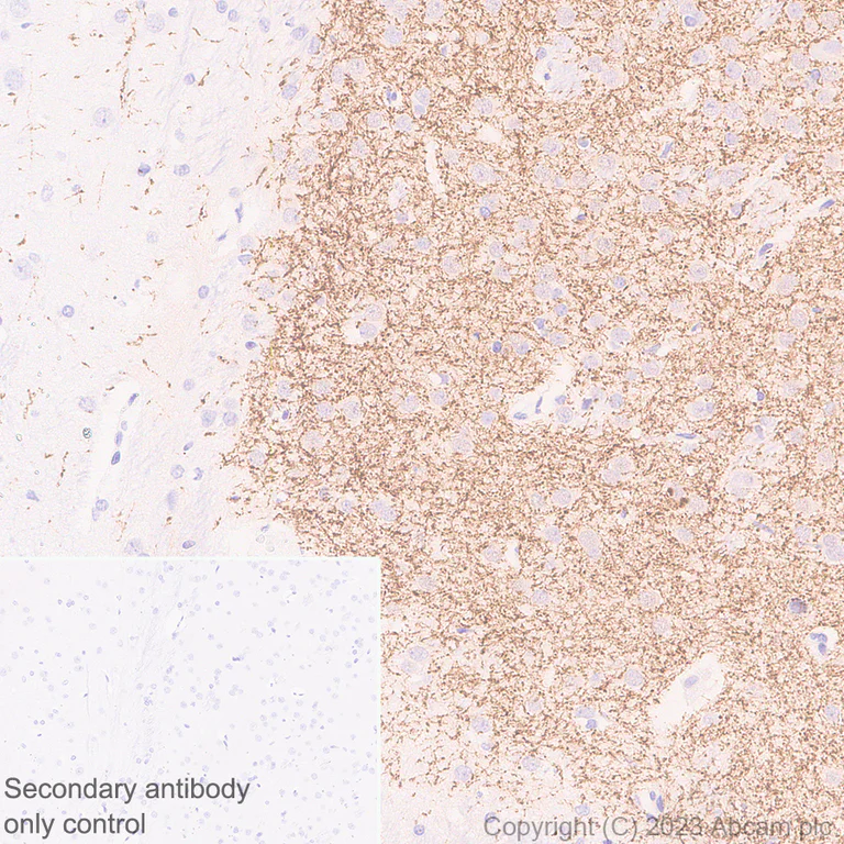 Immunohistochemistry (Formalin/PFA-fixed paraffin-embedded sections) - Anti-Tyrosine Hydroxylase antibody [RM1085] - BSA and Azide free (AB315253)