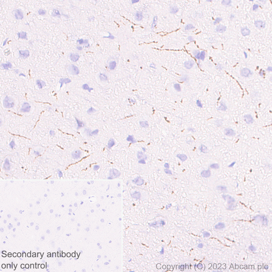 Immunohistochemistry (Formalin/PFA-fixed paraffin-embedded sections) - Anti-Tyrosine Hydroxylase antibody [RM1085] - BSA and Azide free (ab315253), expandable thumbnail