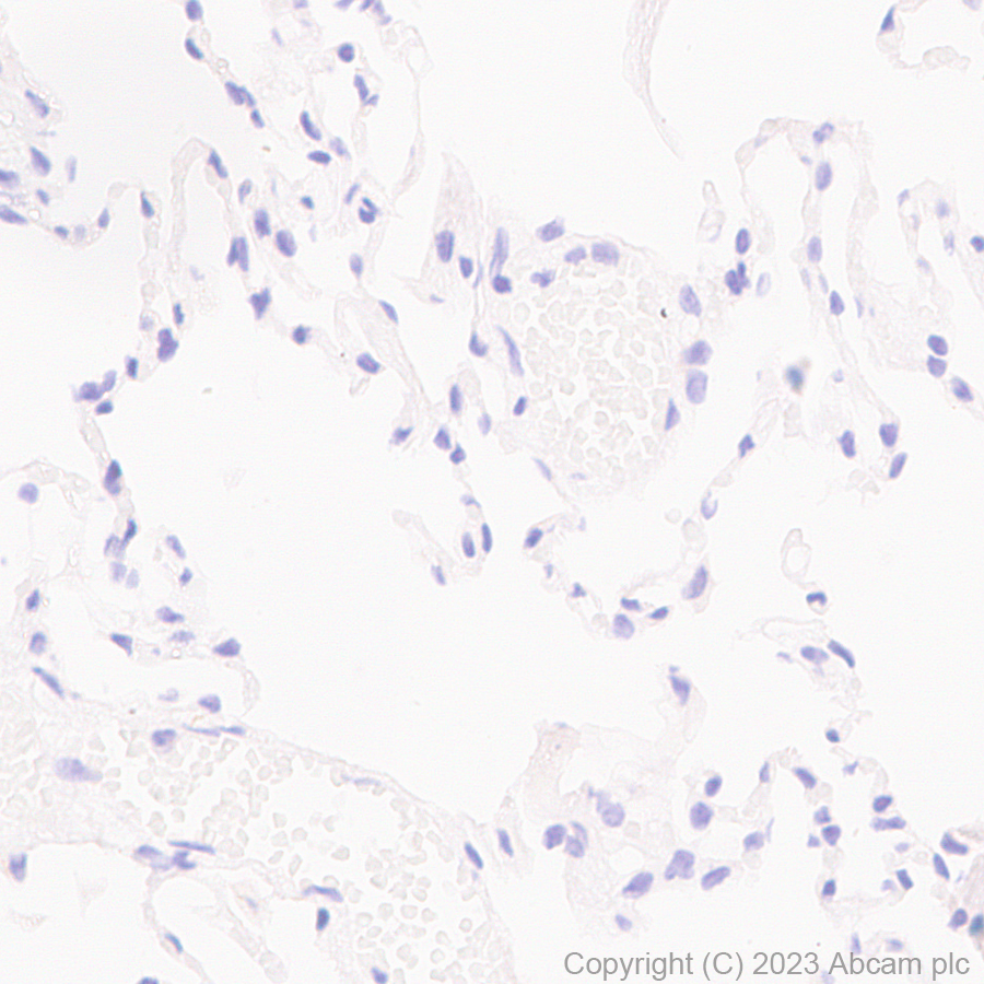 Immunohistochemistry (Formalin/PFA-fixed paraffin-embedded sections) - Anti-Tyrosine Hydroxylase antibody [RM1085] - BSA and Azide free (AB315253), expandable thumbnail