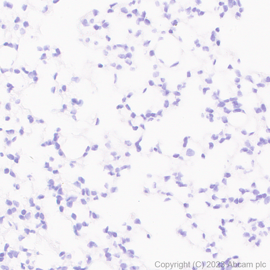 Immunohistochemistry (Formalin/PFA-fixed paraffin-embedded sections) - Anti-Tyrosine Hydroxylase antibody [RM1085] - BSA and Azide free (ab315253), expandable thumbnail