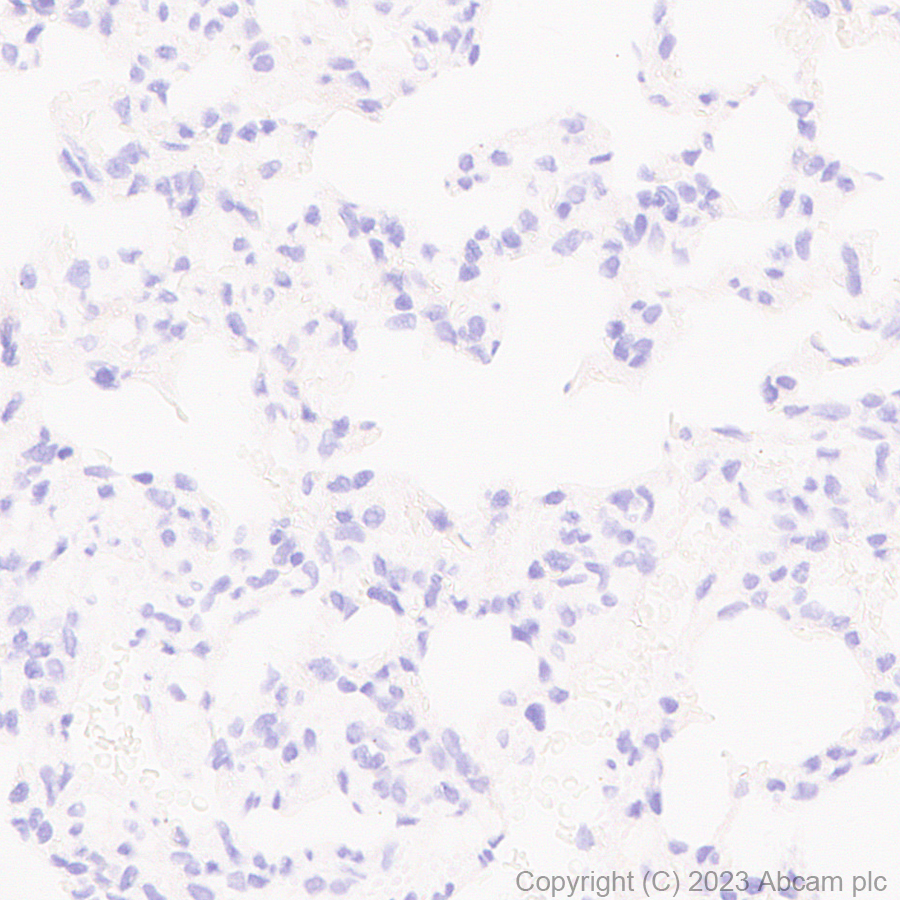 Immunohistochemistry (Formalin/PFA-fixed paraffin-embedded sections) - Anti-Tyrosine Hydroxylase antibody [RM1085] - BSA and Azide free (ab315253), expandable thumbnail