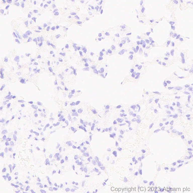 Immunohistochemistry (Formalin/PFA-fixed paraffin-embedded sections) - Anti-Tyrosine Hydroxylase antibody [RM1085] - BSA and Azide free (AB315253)