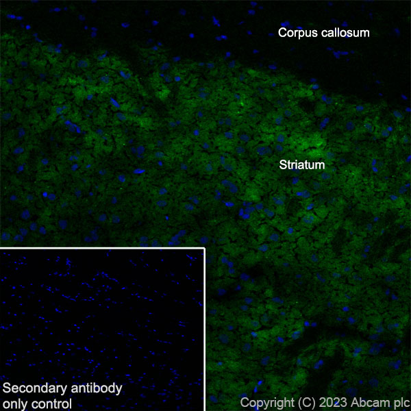 Immunohistochemistry (Frozen sections) - Anti-Tyrosine Hydroxylase antibody [RM1085] - BSA and Azide free (ab315253), expandable thumbnail