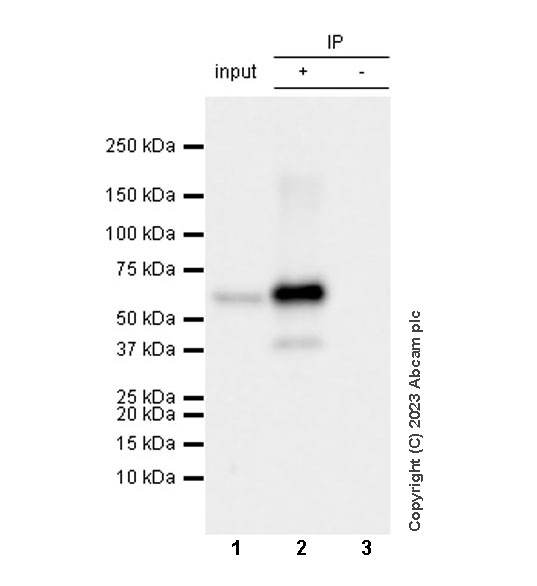 Immunoprecipitation - Anti-Tyrosine Hydroxylase antibody [RM1085] - BSA and Azide free (AB315253), expandable thumbnail