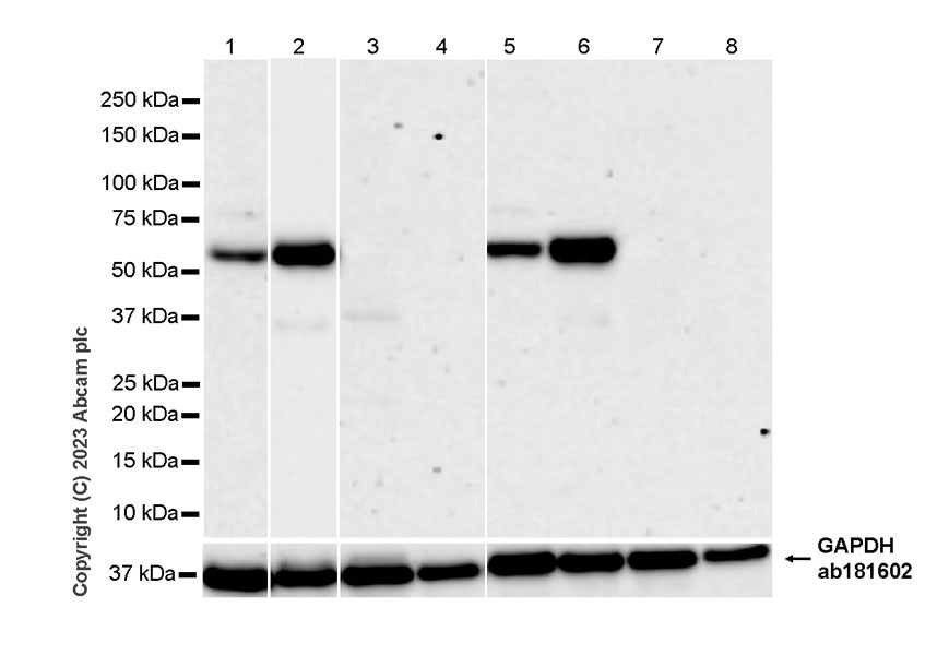 Western blot - Anti-Tyrosine Hydroxylase antibody [RM1085] - BSA and Azide free (ab315253), expandable thumbnail